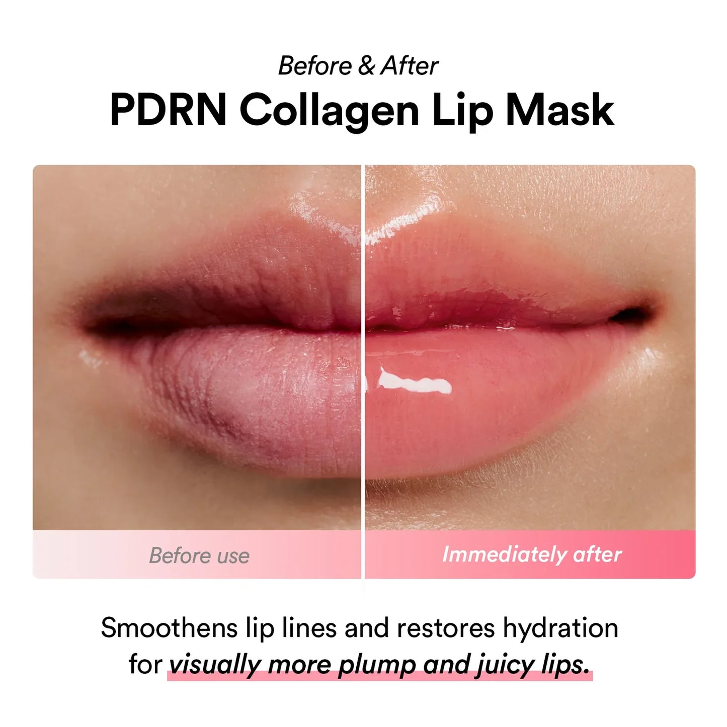 ABIB PDRN Collagen Lip Mask Glazed Jelly-Μάσκα Χειλιών με Ενυδάτωση και Σύσφιξη (11 g)